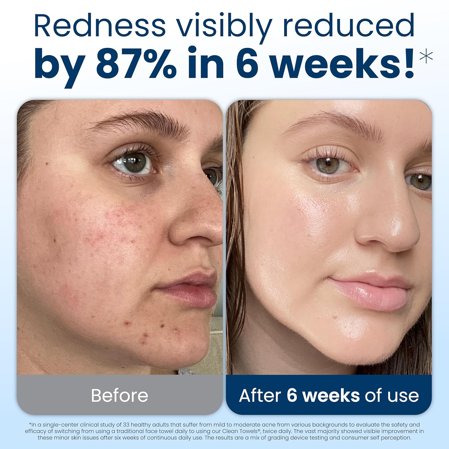 Gentle Clean Face Towels